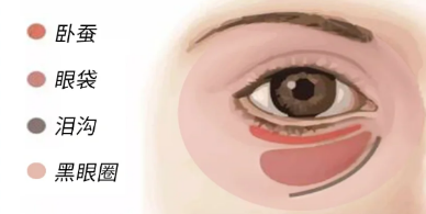 去眼袋手术