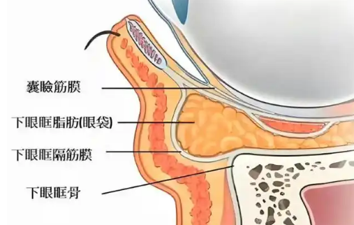 去眼袋手术