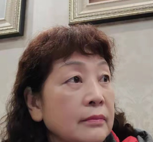 去眼袋手术
