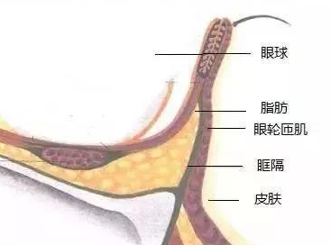 去眼袋手术