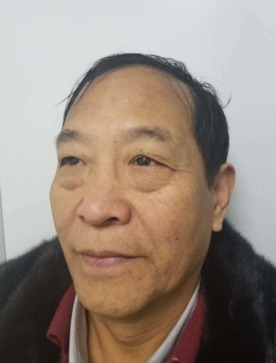 去眼袋手术