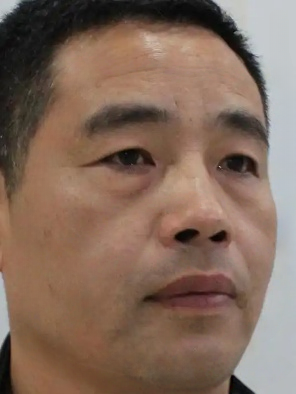 去眼袋手术