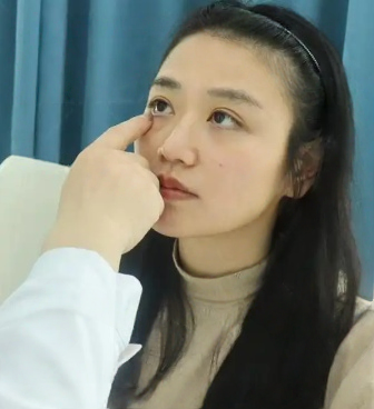 去眼袋手术