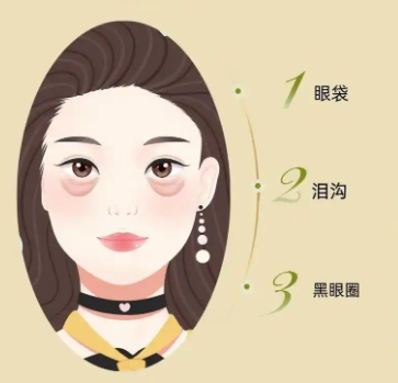 去眼袋手术