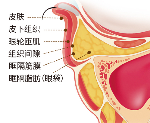 去眼袋手术
