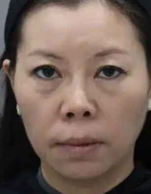 去眼袋手术