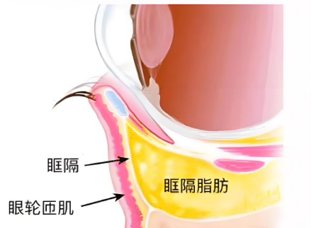去眼袋手术
