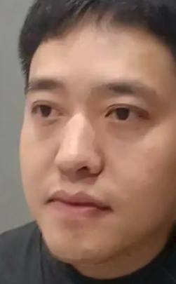 去眼袋手术