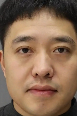 去眼袋手术