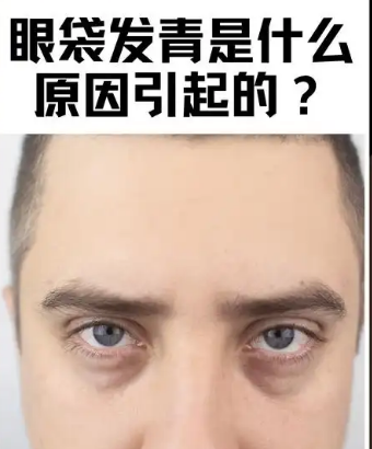 去眼袋手术