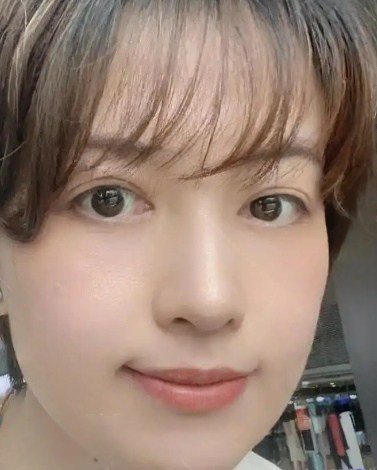 去眼袋手术