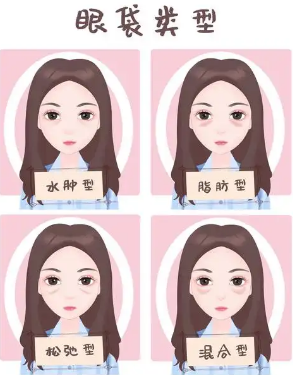 去眼袋手术