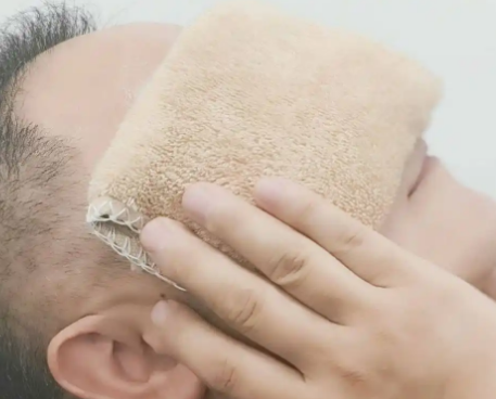 去眼袋手术