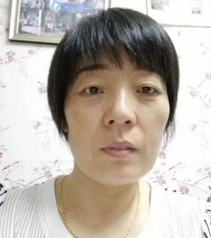 去眼袋手术