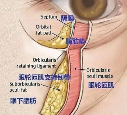 去眼袋手术