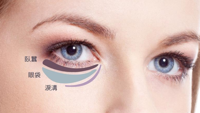 去眼袋手术