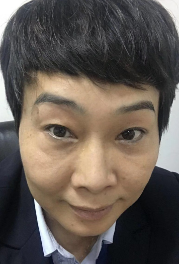 去眼袋手术