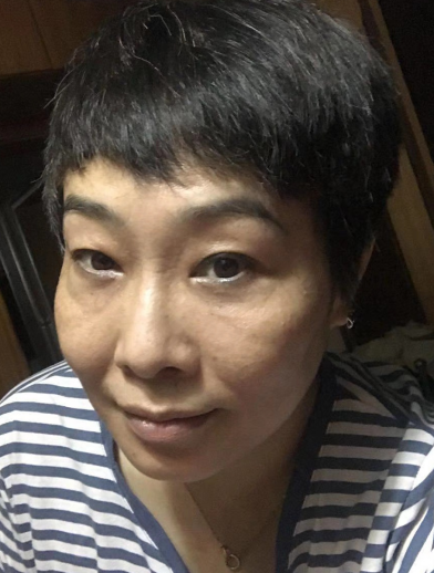 去眼袋手术