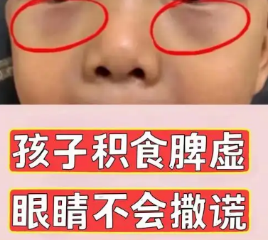 眼袋