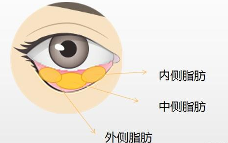 眼袋