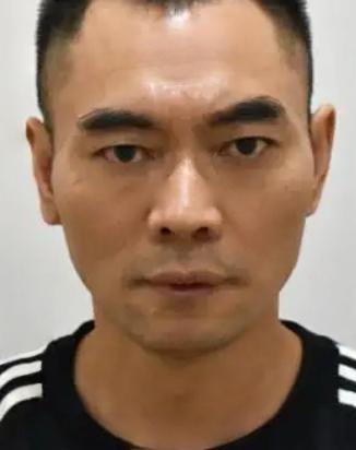 去眼袋手术