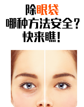 去眼袋手术
