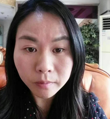 去眼袋手术