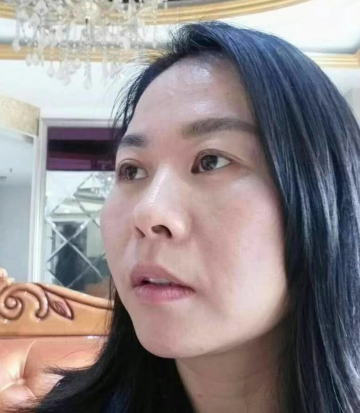 去眼袋手术