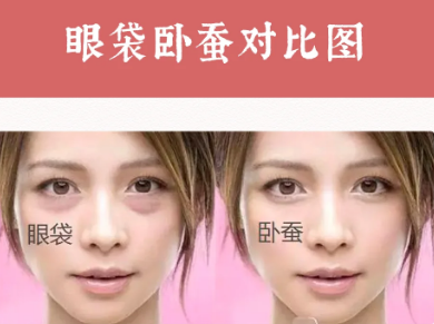 去眼袋手术