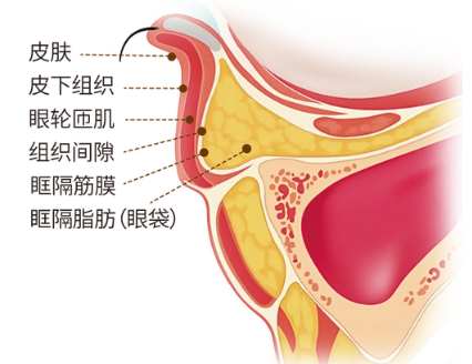 去眼袋手术