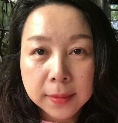 去眼袋手术
