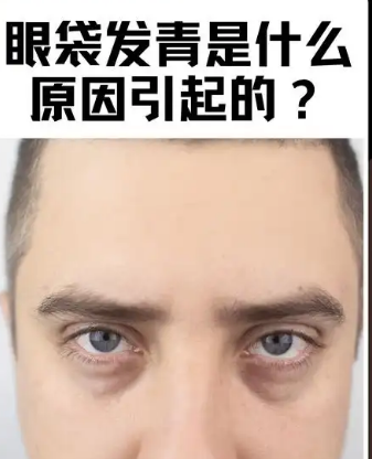 去眼袋手术