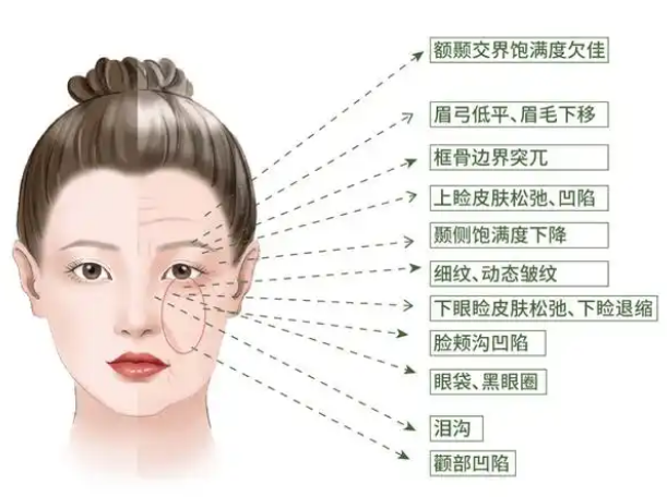 去眼袋手术