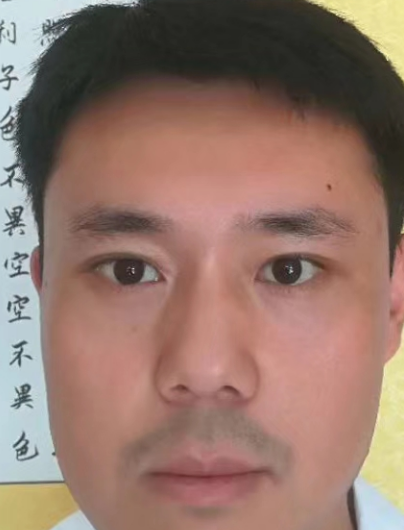 去眼袋手术