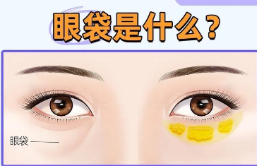 去眼袋手术