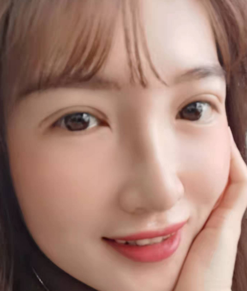 双眼皮手术