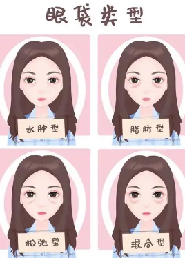 去眼袋手术