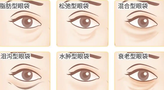 眼袋