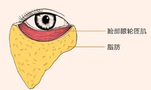 眼袋