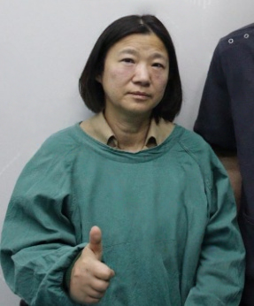 去眼袋手术