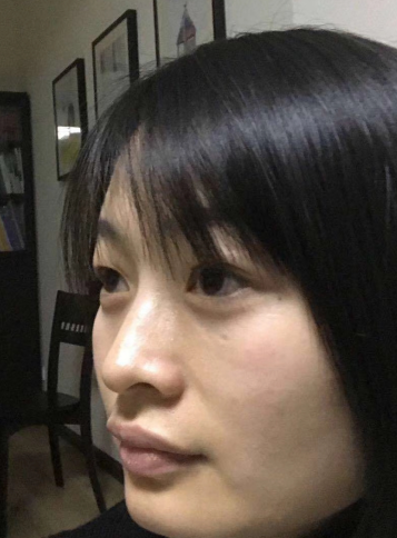 眼袋