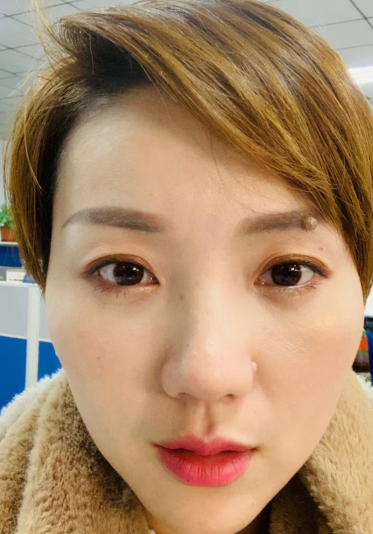 眼袋