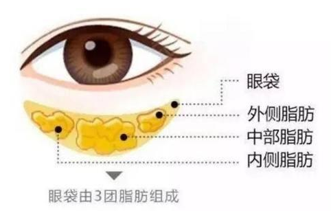 眼袋