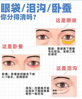 去眼袋手术