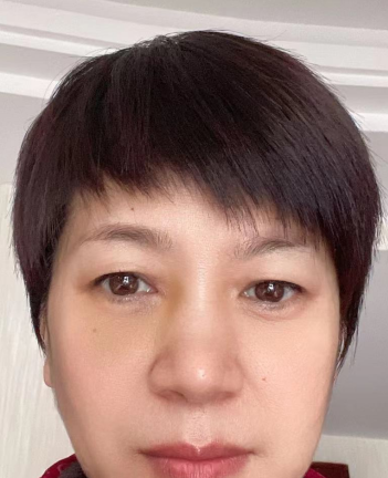 去眼袋手术