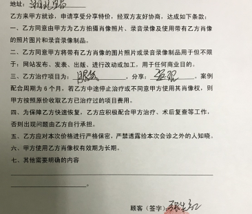 去眼袋手术