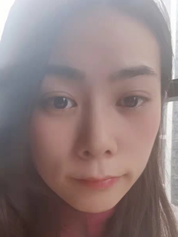 去眼袋手术