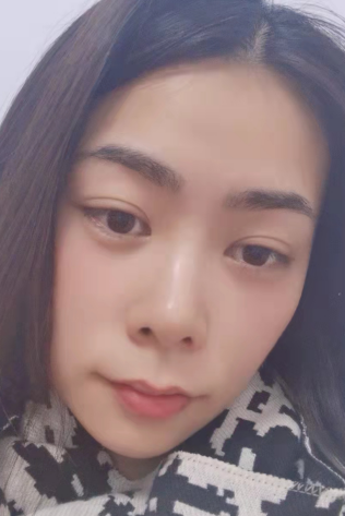 去眼袋手术