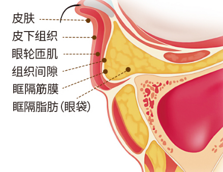 眼袋