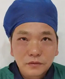 去眼袋手术